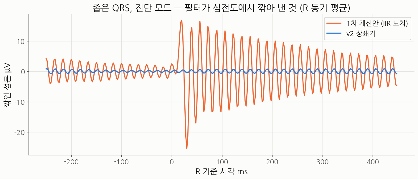 좁은 QRS 에서 노치 깎임 파형 비교